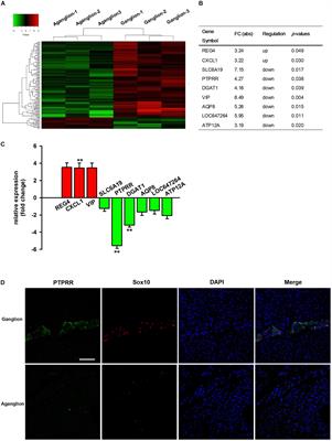 Downregulation of Protein Tyrosine Phosphatase Receptor Type R Accounts for the Progression of Hirschsprung Disease